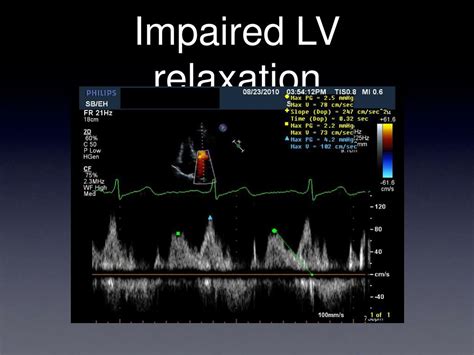 what is impaired lv relaxation